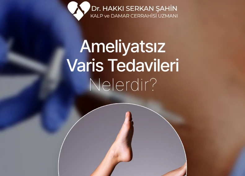 Ameliyatsız Varis Tedavileri Nelerdir?